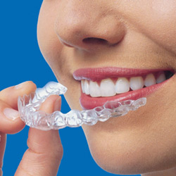 Read more about Invisalign