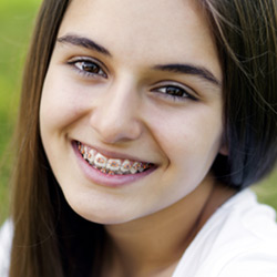 Read more about Types of Braces